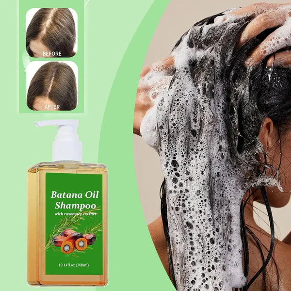 Batana Oil Hair Growth Shampoo with Rosemary – Buy 1 Get 1 Free